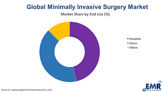 Minimally Invasive Surgery Market by End Use