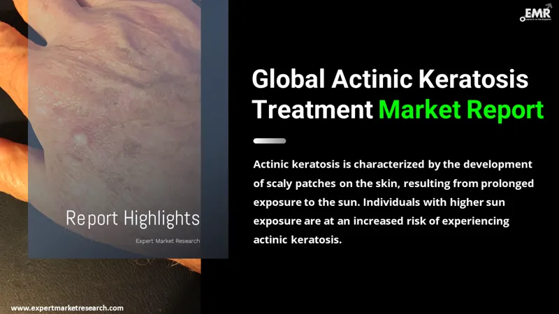 Global Actinic Keratosis Treatment Market