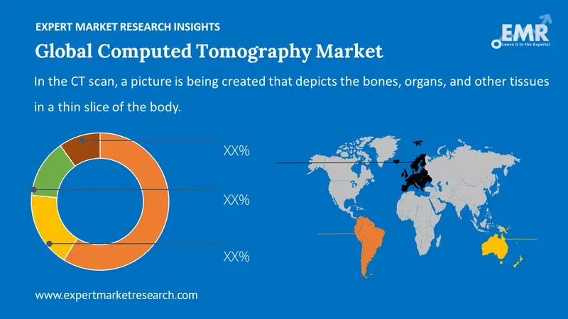 computed tomography market by region