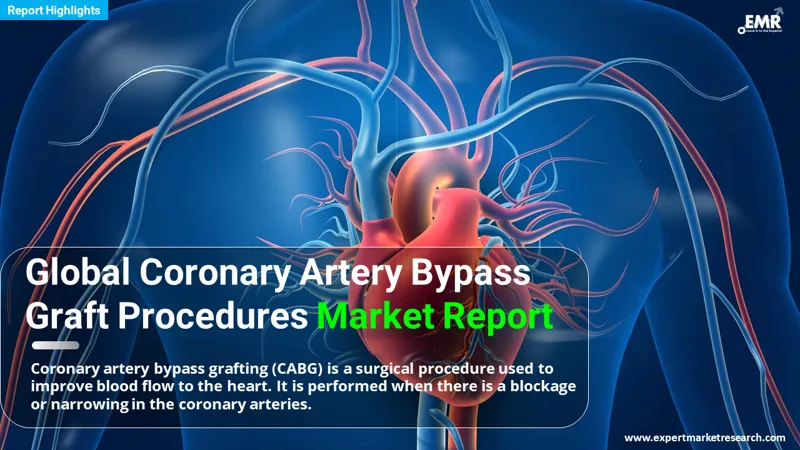 Global Coronary Artery Bypass Graft Procedures Market