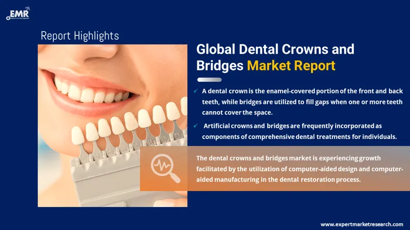 Global Dental Crowns and Bridges Market