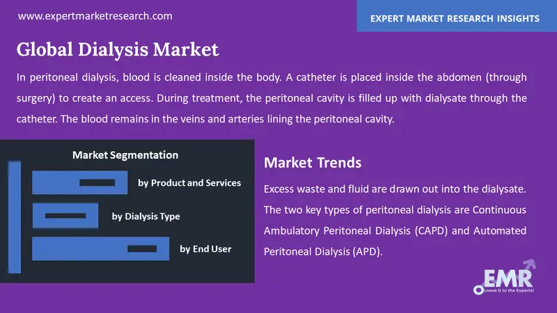 dialysis market by segments