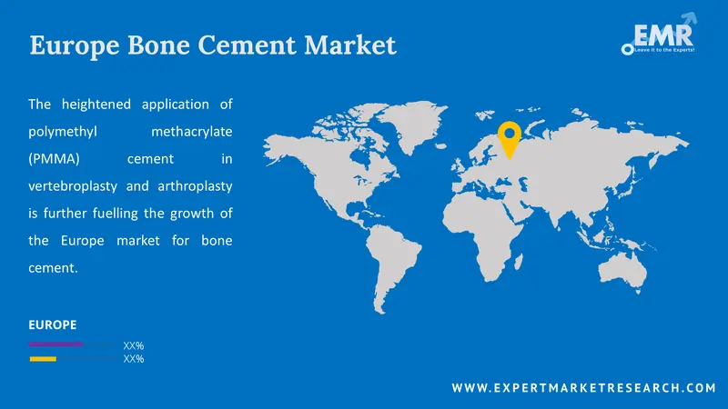 europe bone cement market by region