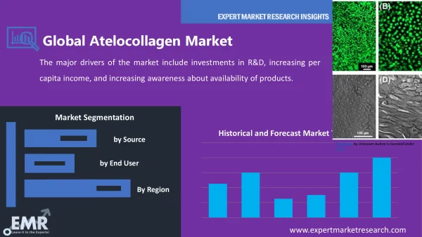 Global Atelocollagen Market by Segments