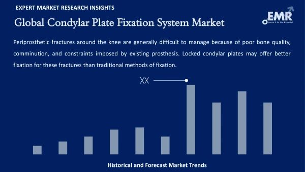 Global Condylar Plate Fixation System Market