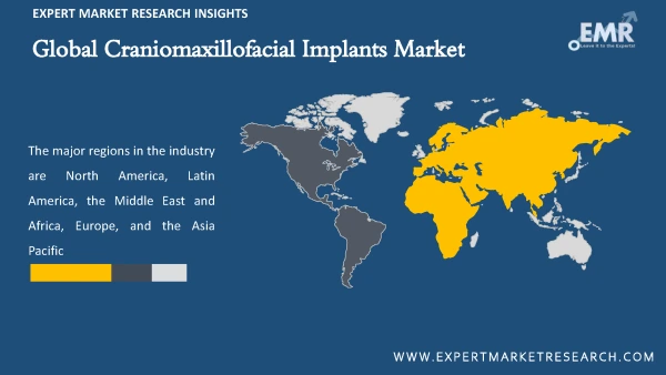 Global Craniomaxillofacial Implants Market by Region