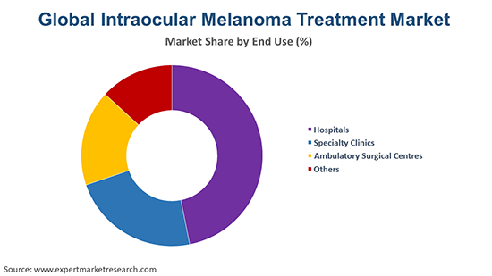 Global Intraocular Melanoma Treatment Market By End Use