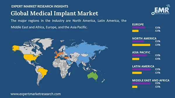 Global Medical Implant Market by Region