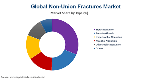Global Non-Union Fractures Market By Type