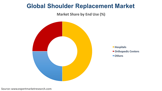 Global Shoulder Replacement Market By End Use