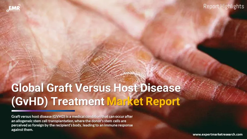 graft versus host disease treatment market