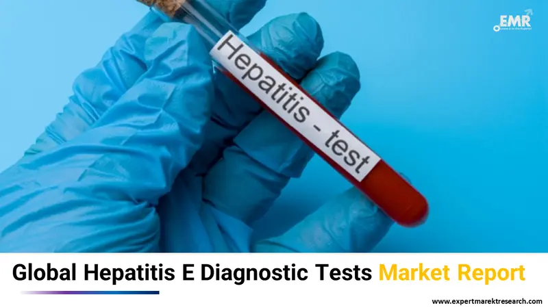 hepatitis e diagnostic tests market