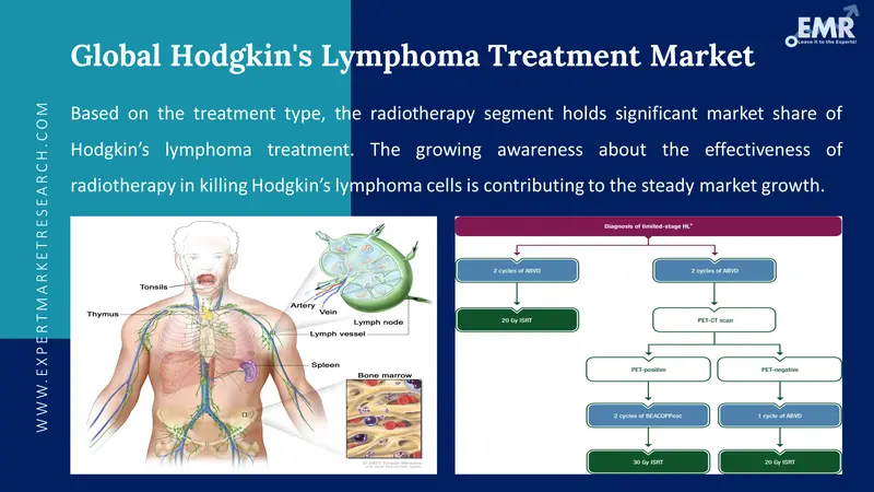 hodgkins lymphoma treatment market