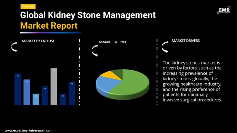 kidney stone management market by segments