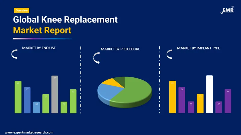 knee replacement market by segments