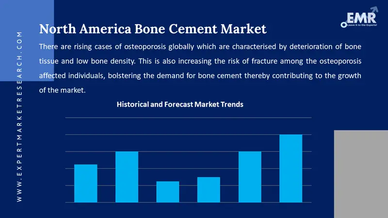 north america bone cement market