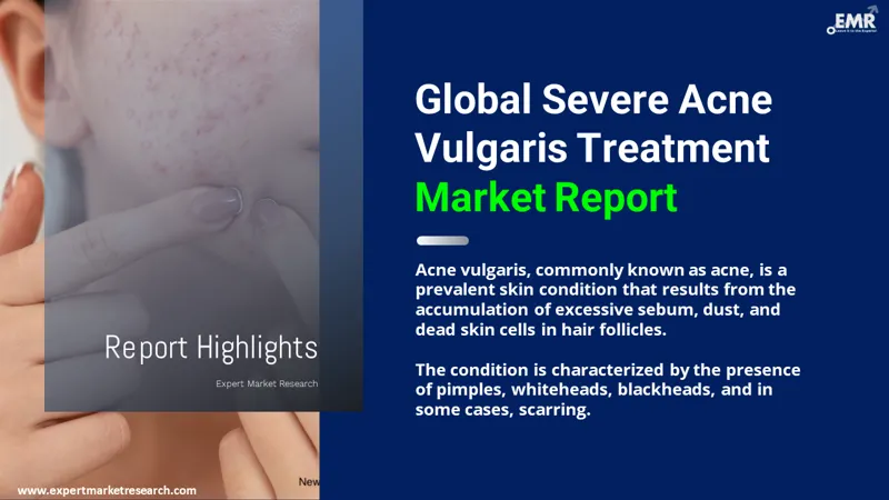 severe acne vulgaris treatment market