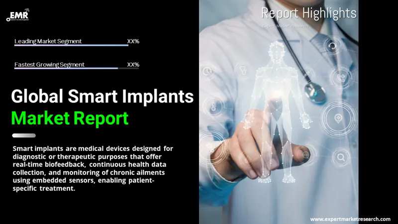 smart implants market