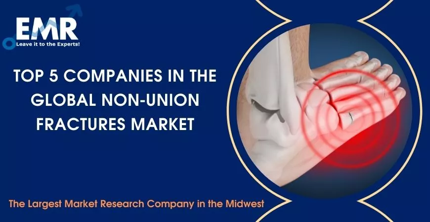 Top 5 Companies in the Global Non-Union Fractures Market
