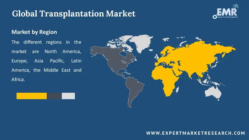 transplantation market by region