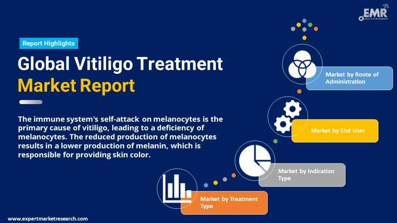 vitiligo treatment market by segments